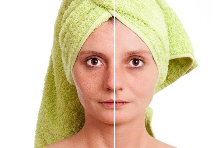 How To Shrink Pores | Effective & Natural Ways To A Youthful Skin...