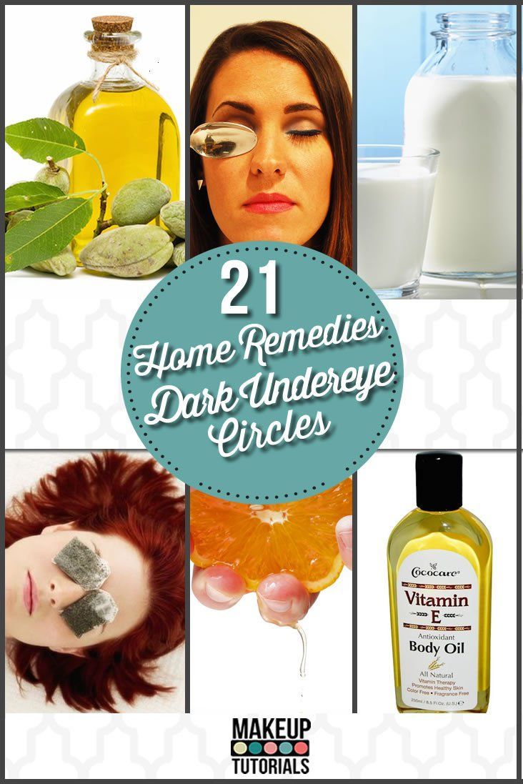 21 Home Remedies For Dark Under Eye Circles